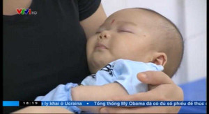 Một số lưu ý về phản ứng sau tiêm chủng ở trẻ