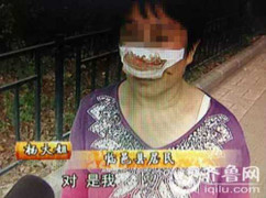 Trung Quốc: Không nghe điện thoại, vợ bị chồng cắn đứt mũi