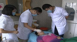 Kinh hoàng chuyện người vợ bị chồng cắn và nuốt mũi