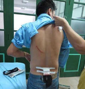 Khởi tố vụ côn đồ chém trọng thương nhà báo ở Thái Nguyên