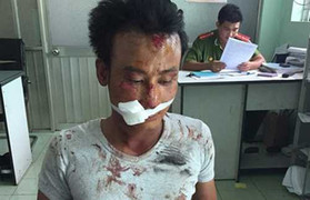 ‘Ngáo đá’ gây tai nạn rồi rút dao chém nạn nhân