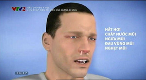 7 lưu ý đối với bệnh viêm mũi xoang dị ứng