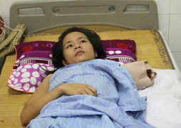 Nữ du khách bị bạch hổ vồ mất cánh tay đã được xuất viện