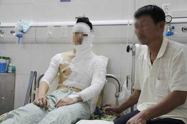 Nghi án nam sinh bị tạt axit vì chuyện tình cảm