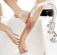 Sơ cứu đúng cách khi bị bỏng xăng