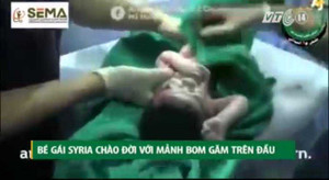 Bé sơ sinh được cứu sống thần kỳ khi mẹ bị trúng mảnh bom