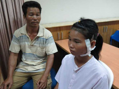 Nữ sinh 13 tuổi bị đạn bi bắn xuyên cổ