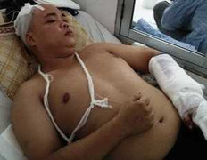 Thanh toán 'ân oán giang hồ', một người bị chém trọng thương