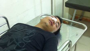 Bị chém đứt sống mũi vì chậm nhường đường