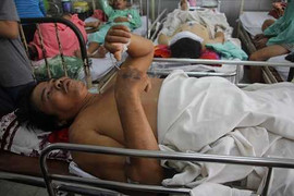 Nạn nhân vụ sập trung tâm tiệc cưới Cần Thơ phải cưa chân