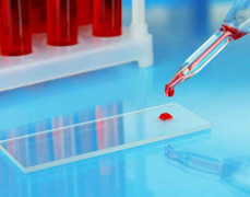 Cách cải thiện chất lượng máu trong cơ thể