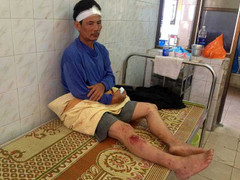 Vụ nổ giật sập 3 căn nhà: Các nạn nhân đã hồi phục