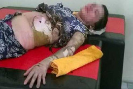 Kinh hoàng chồng lôi vợ ra đường rồi tưới xăng đốt