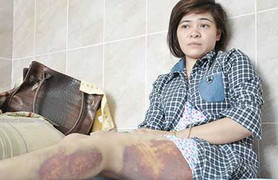 Không thừa nhận ăn trộm, nữ công nhân bị công an đồn đánh túi bụi