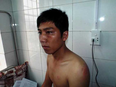 Nam thanh niên tố bị công an xã đánh tại trụ sở ủy ban