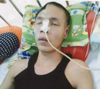 Người đàn ông vỡ xương sọ: Tiếng cầu cứu từ gia đình