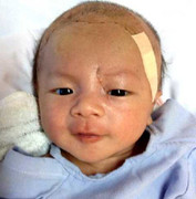 Tin mới nhất về bé trai bị đâm xuyên não