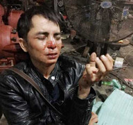 Làm rõ tin lính biên phòng cửa khẩu Bờ Y đánh người