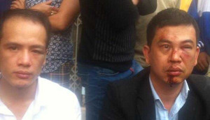 Giám đốc Công an Hà Nội lên tiếng việc 2 luật sư bị hành hung