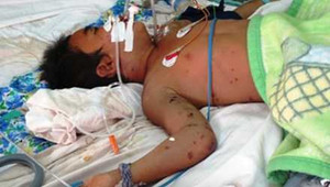 Bác sỹ Bạch Mai đang khẩn trương cấp cứu 50 bệnh nhi bị ong đốt