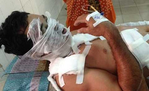 Đòi tiền sinh đẻ không được, vợ mang bầu tạt axit chồng cũ
