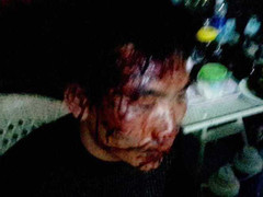 Xe khách giành tuyến, gọi côn đồ đánh dằn mặt đối thủ