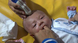 Tình trạng sức khỏe bé trai bị đâm xuyên sọ giờ ra sao?