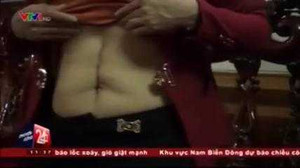 Vụ ‘mất lá lách’ ở Hà Tĩnh: Bệnh viện kết luận ‘Lá lách vẫn nguyên vẹn’