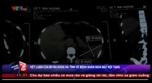 Bệnh nhân mất một phần lá lách sau phẫu thuật chửa ngoài dạ con?