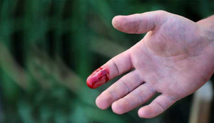 'Lận lưng' 9 bí quyết cầm máu cho người yếu tim