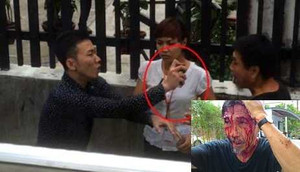 Video: Kinh hoàng ‘đầu gấu’ phá cổng chung cư, đập vỡ đầu cư dân