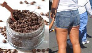 Loại bỏ vùng da đùi nhàu nhĩ một lần và mãi mãi