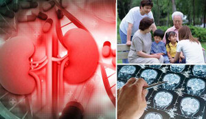 12 loại ung thư có thể di truyền trong gia đình