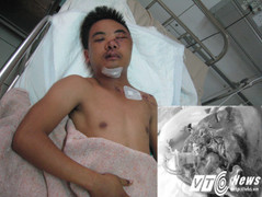 Cứu sống nạn nhân bị tai nạn giao thông nát mặt mũi