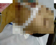 Hoàn tất cáo trạng vụ bị can Đỗ Đăng Dư bị đánh tử vong