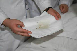 Uống trà đá sỏi thận đeo bám cơ thể