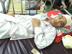 Đi đòi lương cho vợ, chồng bị bảo vệ công ty chém đứt gân, chấn thương sọ não