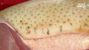 Ăn bì lợn có thể bị thủng dạ dày