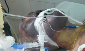 Kết cục hãi hùng sau khi ăn tiết canh lợn Tết