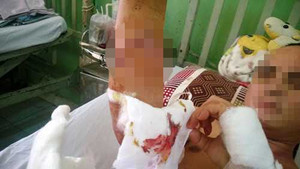 Đang làm nhiệm vụ, một cán bộ tiếp dân của Thanh tra Chính phủ bị chém