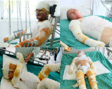 Nổ khí gas sập nhà, 4 người nhập viện: Gia đình trẻ giờ sống ra sao?