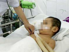 Tai nạn thương tâm với trẻ em ngày Tết: Bố mẹ cần lưu ý