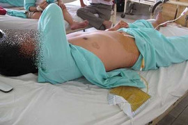 Vợ cắt phăng 'của quý' của chồng rồi bỏ trốn