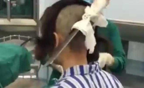 Clip: Phát hiện chồng có bồ, vợ 'bổ' đầu chồng bằng... dao thái thịt