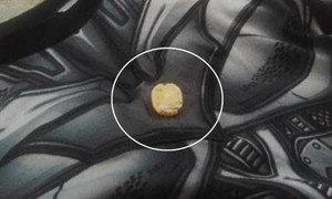 'Vật thể lạ trong áo Trung Quốc' khiến bé trai ngất xỉu: Chuyên gia nêu nghi vấn