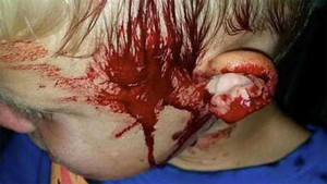 Xót xa cảnh rắn cắn đầu bé trai tóe máu