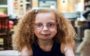 Cuộc phẫu thuật thần kỳ cho khuôn mặt