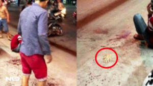 Clip: Thanh niên bị giang hồ chém đứt lìa tay