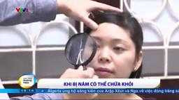 Điều trị nám đúng cách