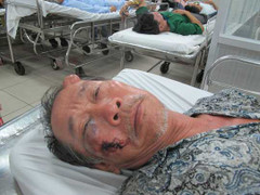 Hung hãn cầm tuýp sắt đánh ông lão tật nguyền để cướp vé số